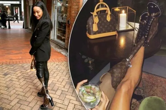 Un model care și-a pierdut piciorul și-a făcut un membru protetic dintr-o geantă Louis Vuitton