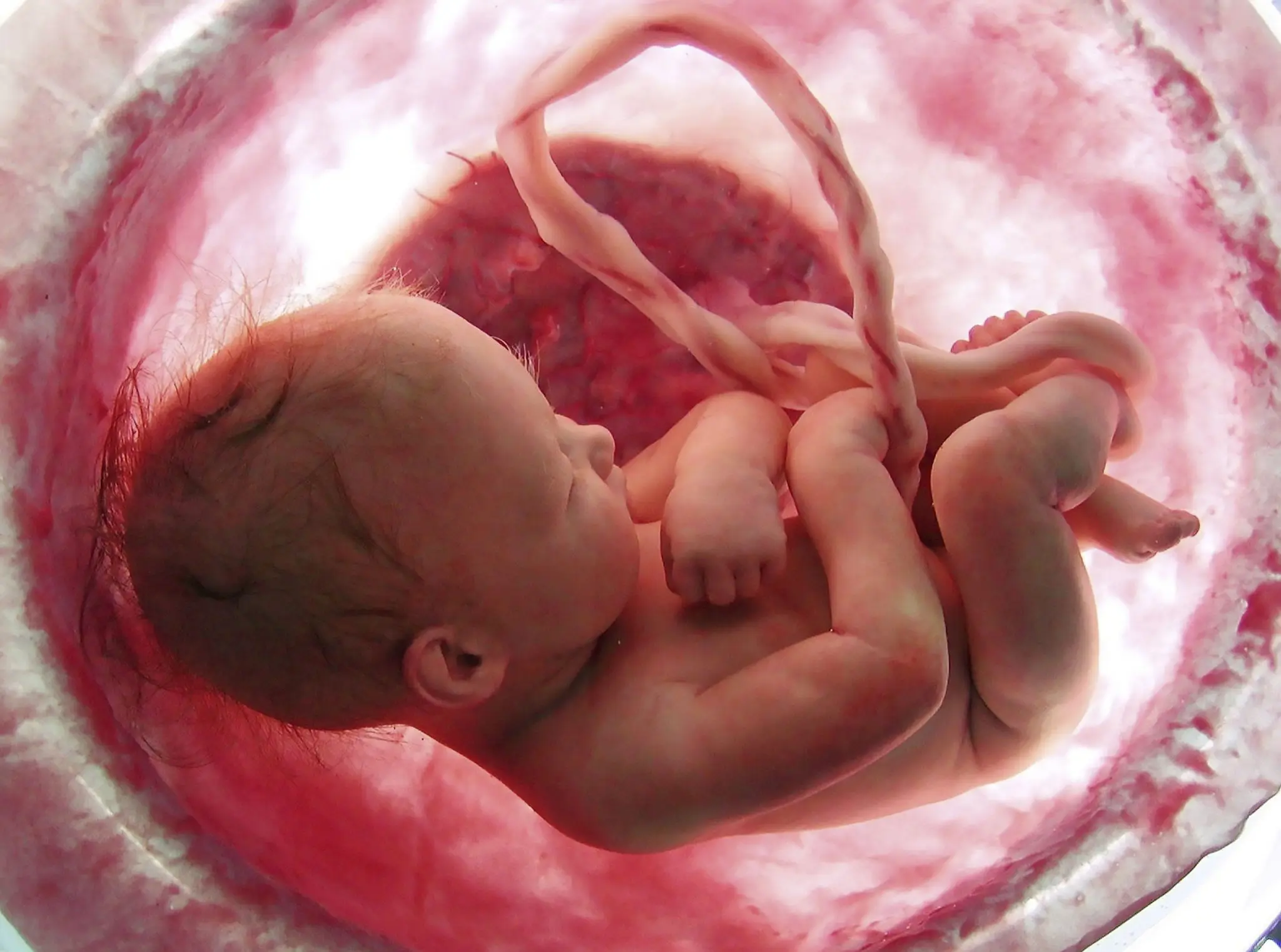 Placenta